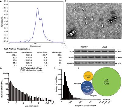 Exosomal Circular RNA RNA-seq Profiling and the Carcinogenic Role of Exosomal circ-CYP24A1 in Cutaneous Squamous Cell Carcinoma